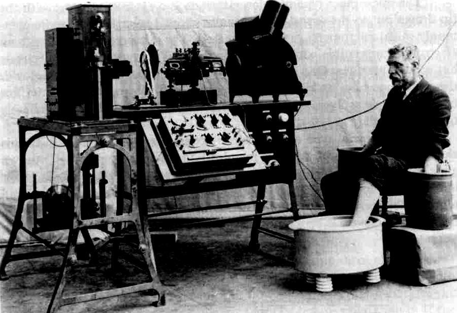 Early electrocardiograph
