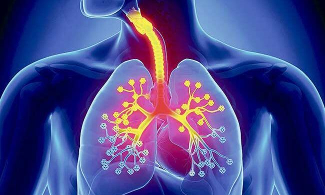 Bronchitis research