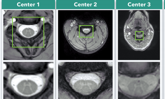 Medical Imaging